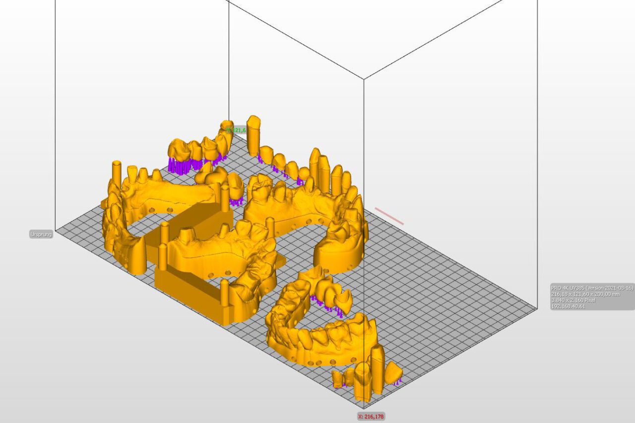 3D-Druck Modelle und Provisorien im Slicing-Tool