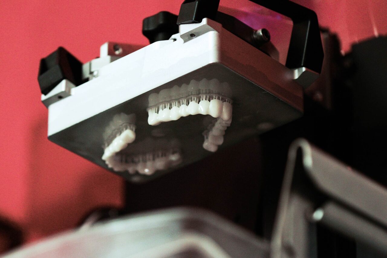 Zähne im 3D-Drucker